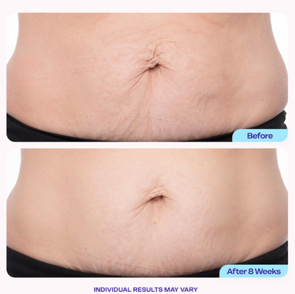Tighten and Smooth Belly Cream